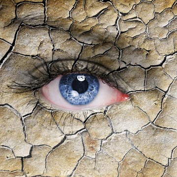 Dry Eye Disease diagnosis and treatment